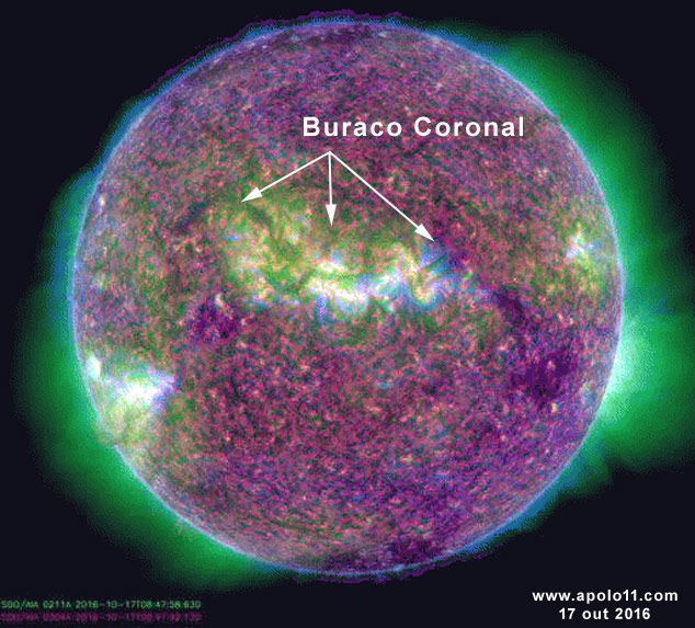 Buraco Coronal